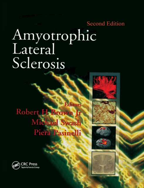 Amyotrophic Lateral Sclerosis, Second Edition