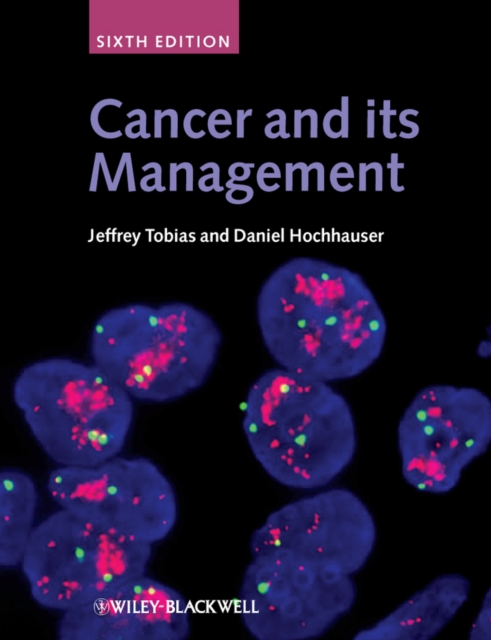 Cancer and its Management