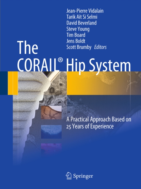 CORAIL(R) Hip System