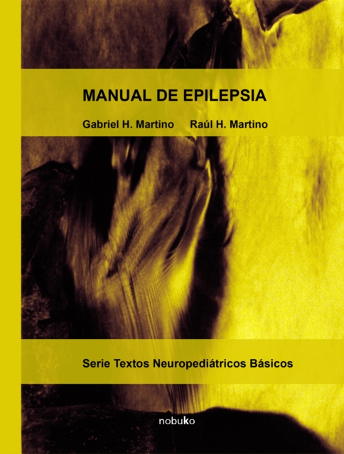 Manual de epilepsia
