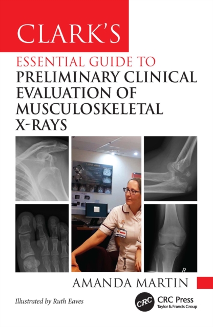 Clark's Essential Guide to Preliminary Clinical Evaluation of Musculoskeletal X-rays