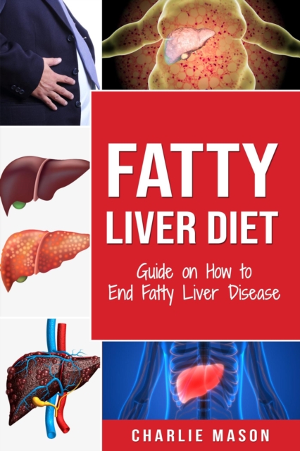 Fatty Liver Diet: Guide on How to End Fatty Liver Disease
