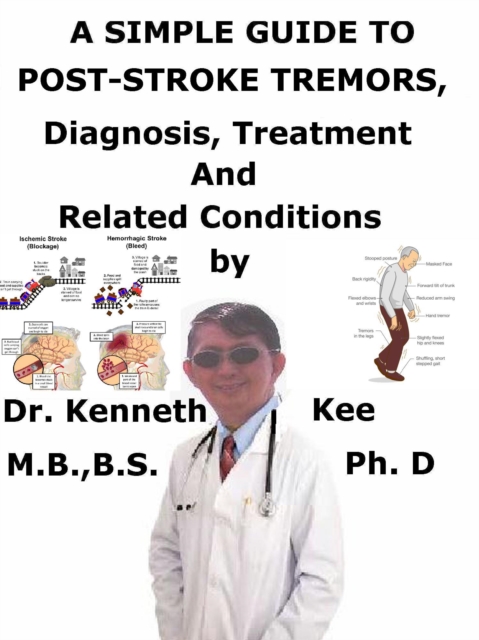 Simple Guide to Post-stroke Tremors, Diagnosis, Treatment and Related Conditions