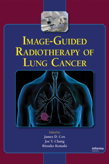 Image-Guided Radiotherapy of Lung Cancer