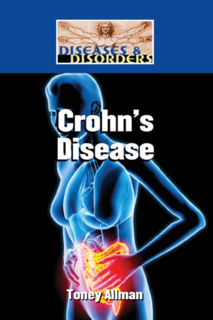 Crohn's Disease
