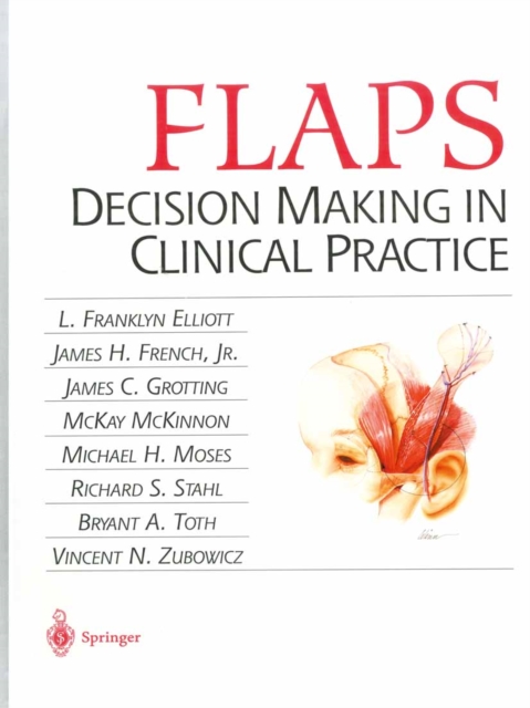FLAPS