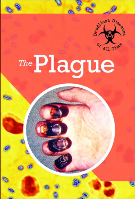 Plague