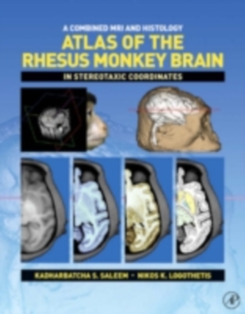 Combined MRI and Histology Atlas of the Rhesus Monkey Brain in Stereotaxic Coordinates