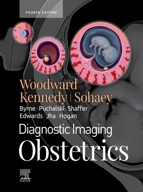 Neuroma, Neural interface, and Prosthetics, An Issue of Hand Clinics, E-Book