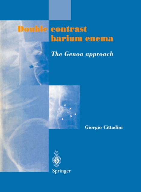 Double contrast barium enema