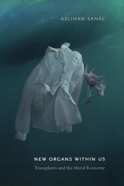 New Organs Within Us