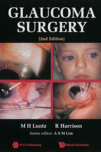 Glaucoma Surgery (2nd Edition)