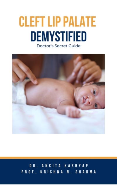 Cleft Lip Palate Demystified: Doctor's Secret Guide