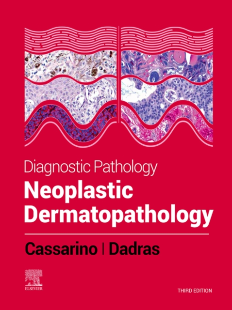 Diagnostic Imaging: Chest - E-Book