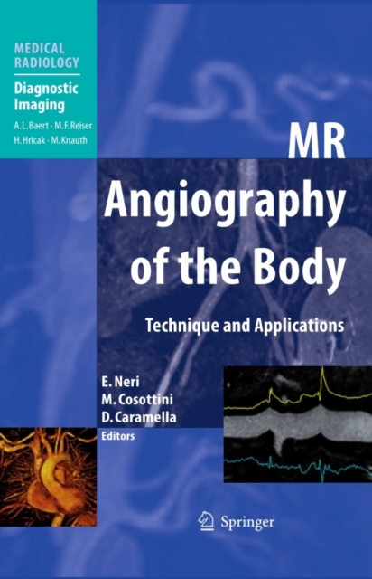 MR Angiography of the Body