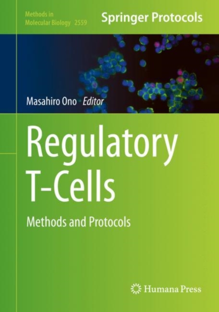 Regulatory T-Cells