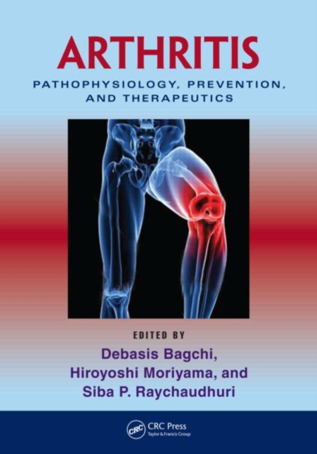 Arthritis