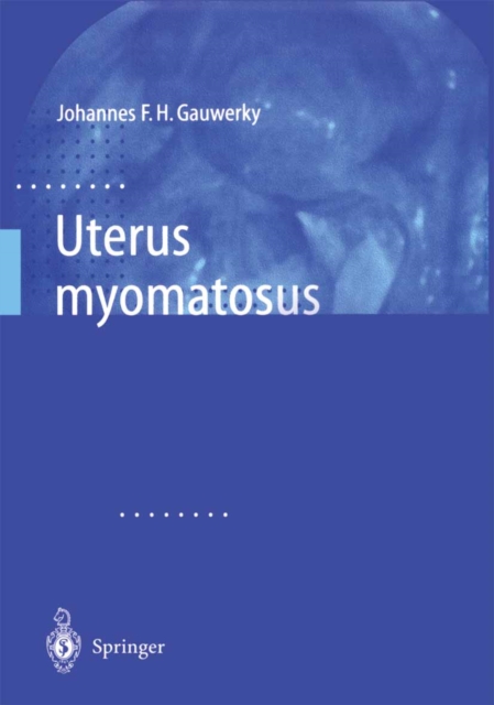 Uterus myomatosus