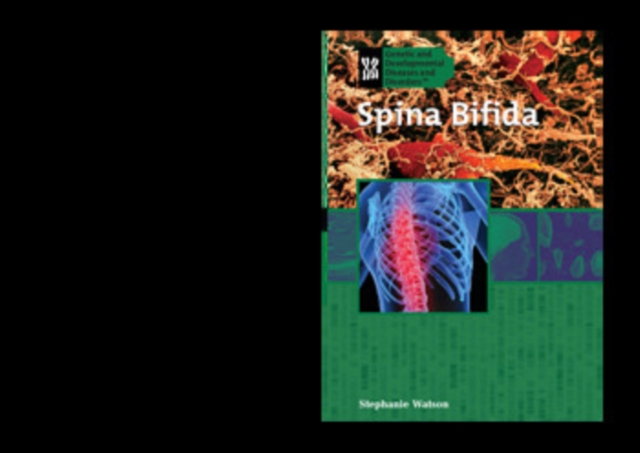 Spina Bifida