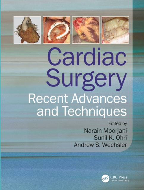 Cardiac Surgery