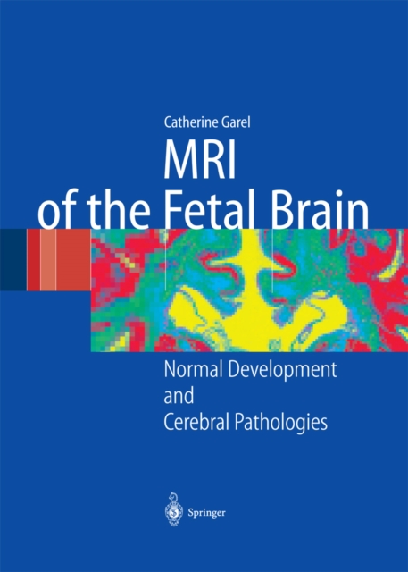 MRI of the Fetal Brain