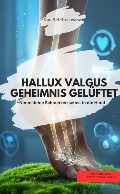 HALLUX VALGUS GEHEIMNIS GELÜFTET –  Nimm deine Schmerzen selbst in die Hand