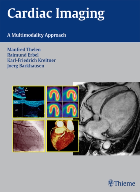Cardiac Imaging
