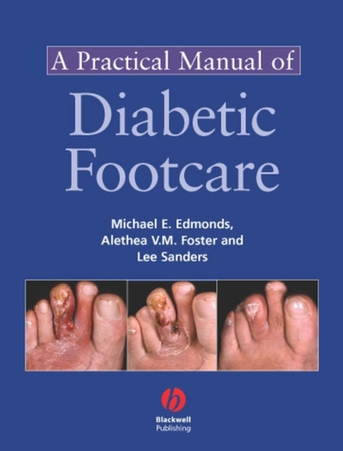 Practical Manual of Diabetic Foot Care