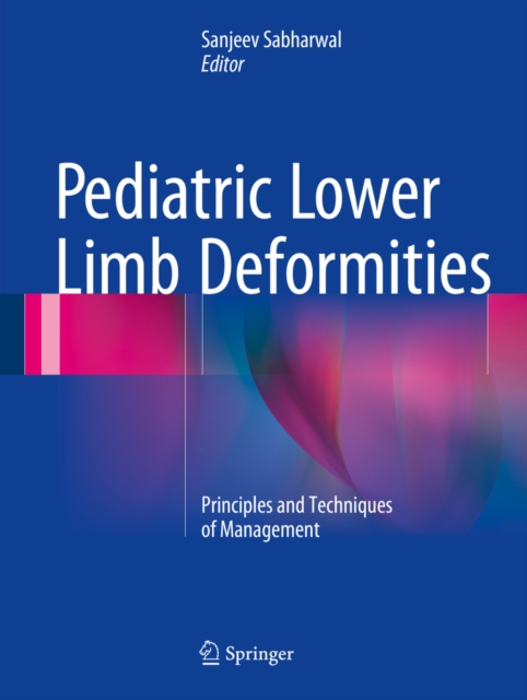 Pediatric Lower Limb Deformities