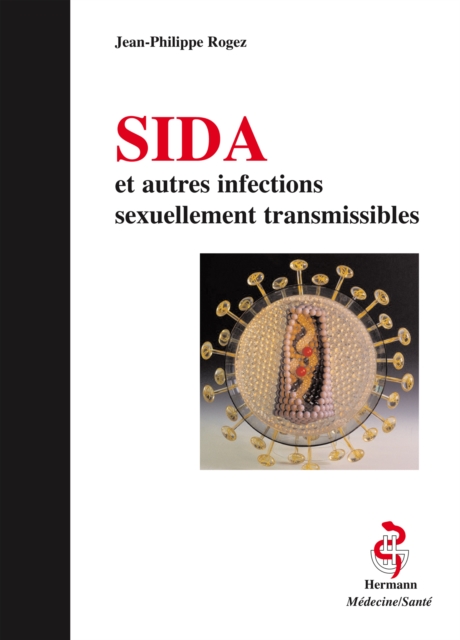 SIDA et autres infections sexuellements transmissibles