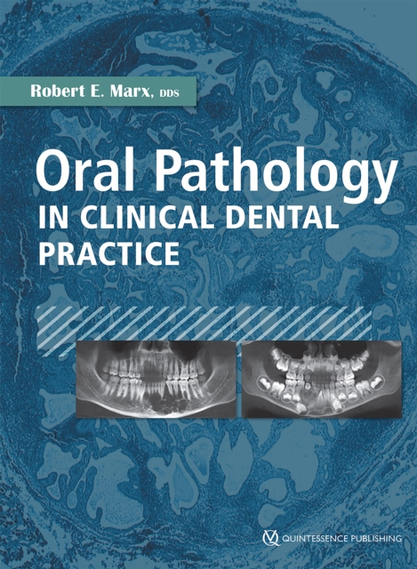 Dentistry and the Pregnant Patient