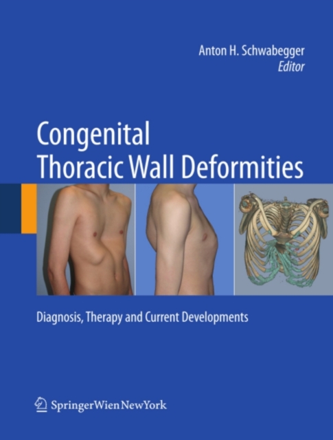 Congenital Thoracic Wall Deformities