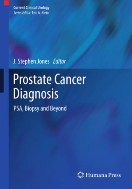 Prostate Cancer Diagnosis