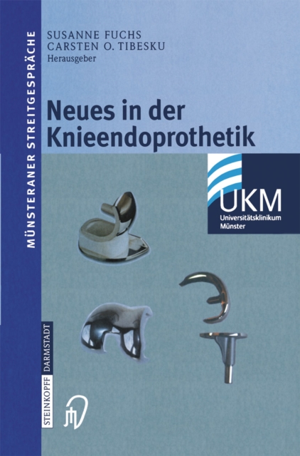 Neues in der Knieendoprothetik