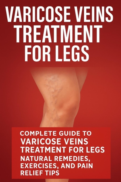 Varicose Veins Treatment for Legs: Natural Varicose Veins Treatment Remedies, Exercises and Pain Relief Tips