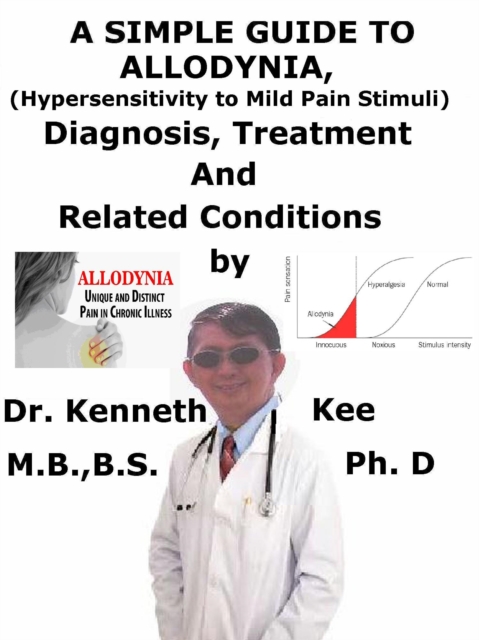 Simple Guide to Allodynia, (Hypersensitivity to Mild Pain Stimuli) Diagnosis, Treatment and Related Conditions