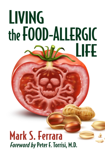 Living the Food-Allergic Life