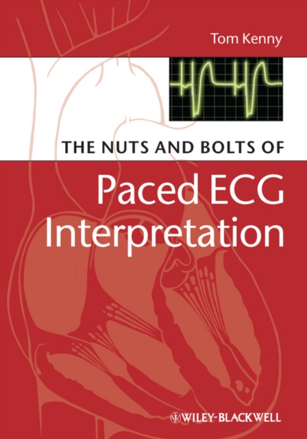 Pharmacological Treatment of Acute Coronary Syndromes