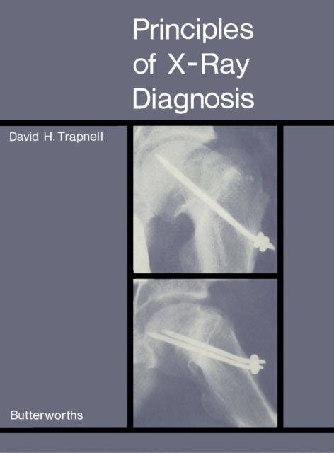 Principles of X-Ray Diagnosis