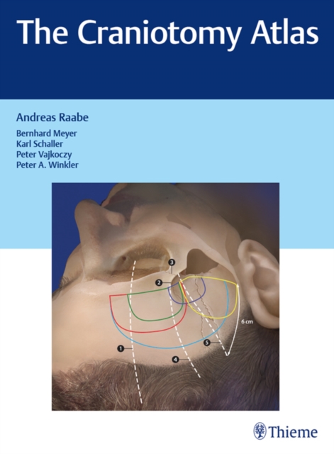 Craniotomy Atlas