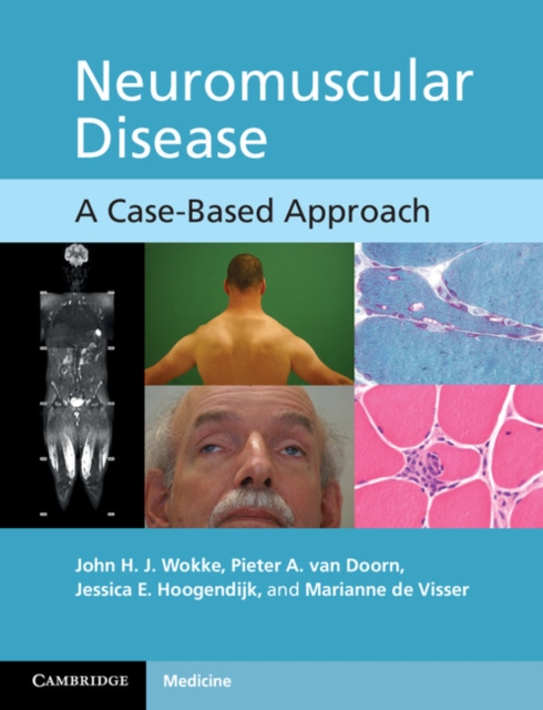 Neuromuscular Disease