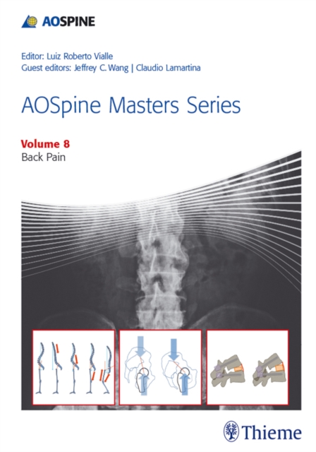 AOSpine Masters Series, Volume 8: Back Pain
