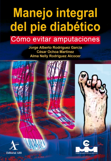 Manejo integral del pie diabetico. Como evitar amputaciones
