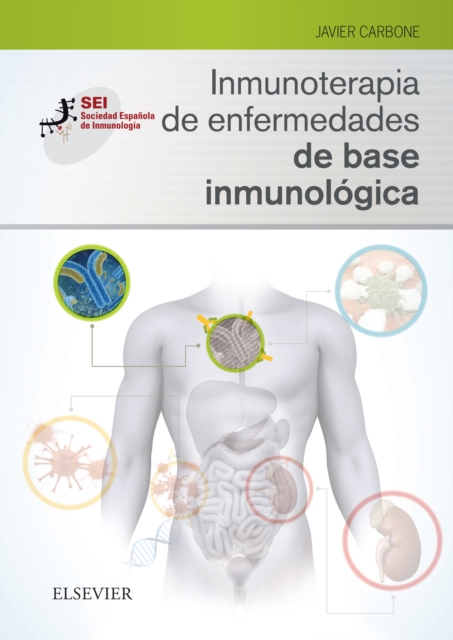 Inmunoterapia de enfermedades de base inmunológica