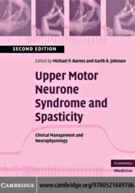 Upper Motor Neurone Syndrome and Spasticity