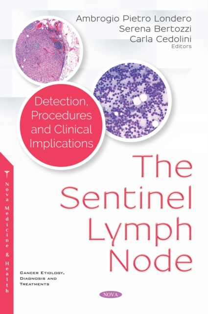 Sentinel Lymph Node: Detection, Procedures and Clinical Implications