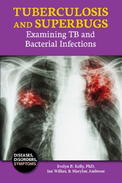 Tuberculosis and Superbugs