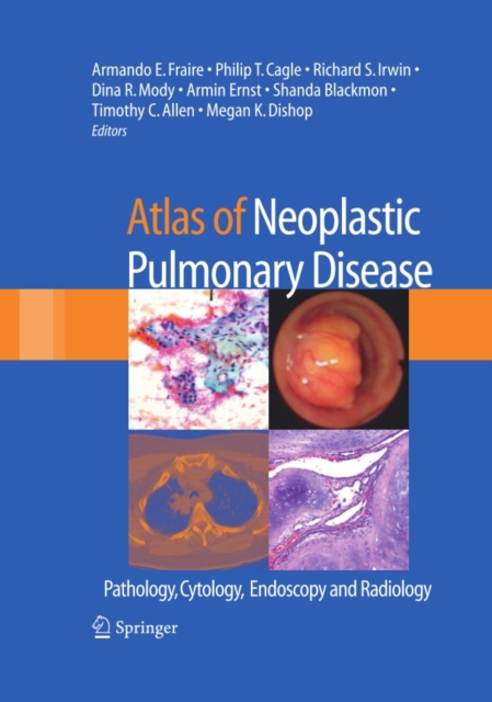 Atlas of Neoplastic Pulmonary Disease
