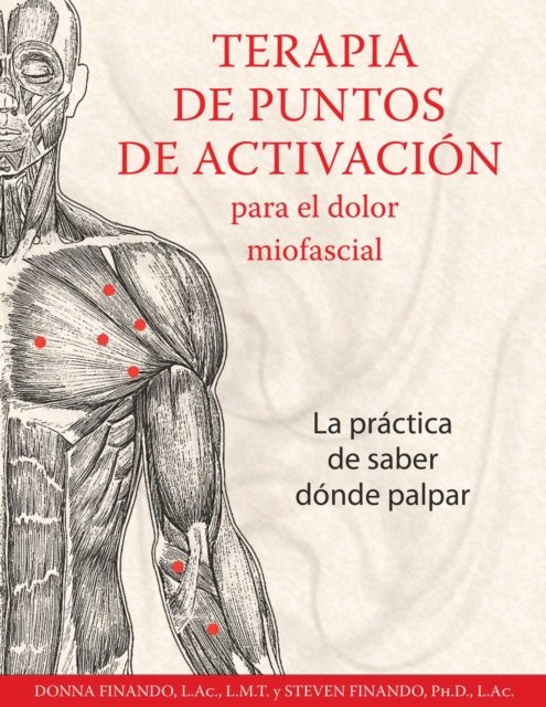 Terapia de puntos de activación para el dolor miofascial