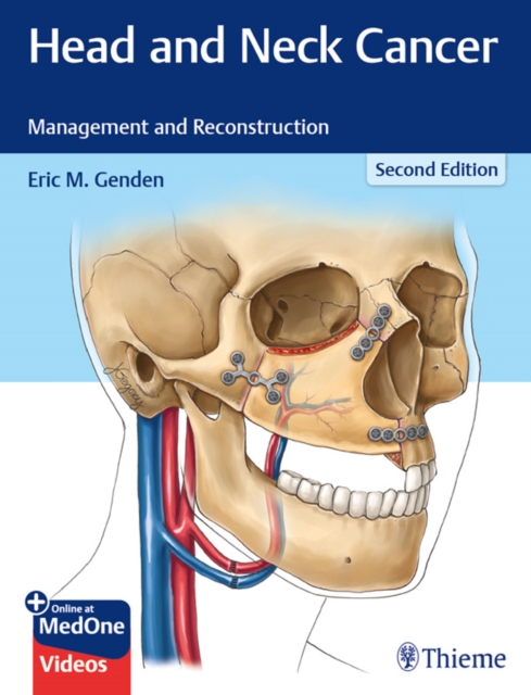 Head and Neck Cancer